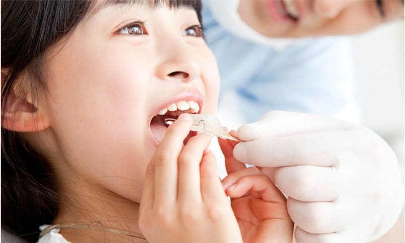 歯並びをきれいにしたい